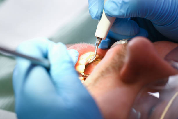 Best Walk-In Emergency Dental Services in Cass City, MI