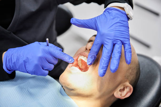 Best Emergency Dental Care for Sports Injuries in Cass City, MI